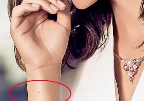 女人左手腕有痣图解