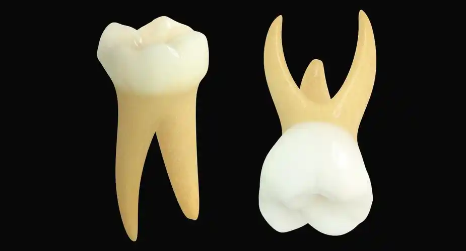 小学第二磨牙3d模型