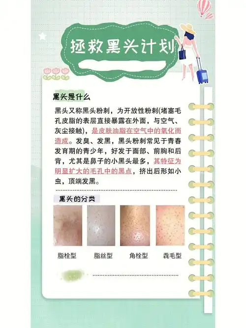 去黑头的有效方法