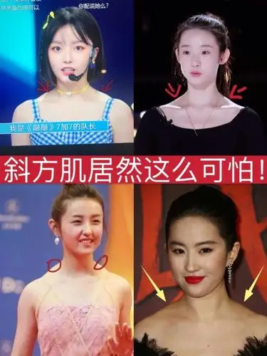 明星都摆脱不了斜方肌的烦恼!如果你想穿衣有型变身行_圈子-新氧美容