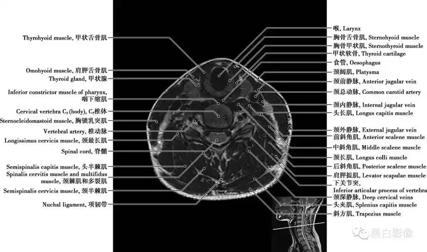 详细的颈椎mri正常解剖图谱,带标注,值得收藏!