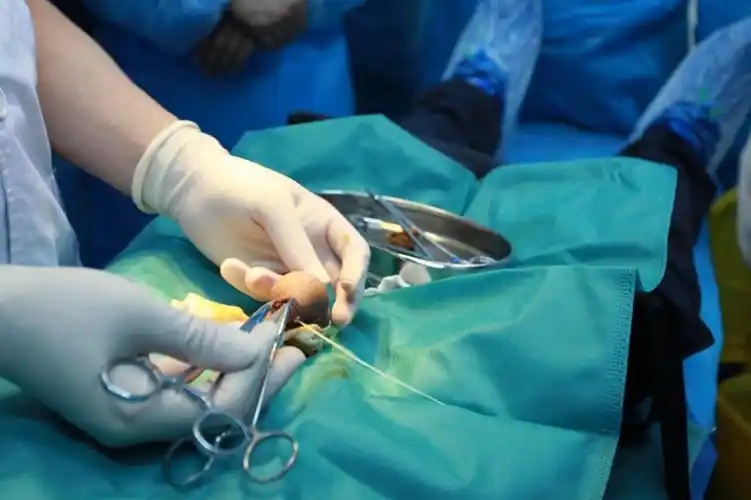 岁少年包茎手术前照片_有来医生