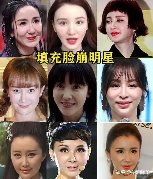敢对自己动刀的人:盘点8位疑似整容的女星,变美真能改变人生?