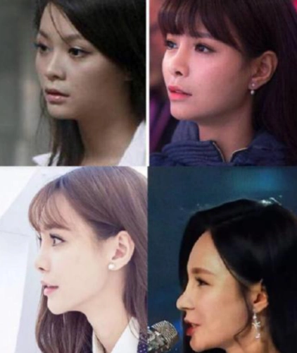 沈梦辰前后对比照沈梦辰变脸后撞脸多个女星