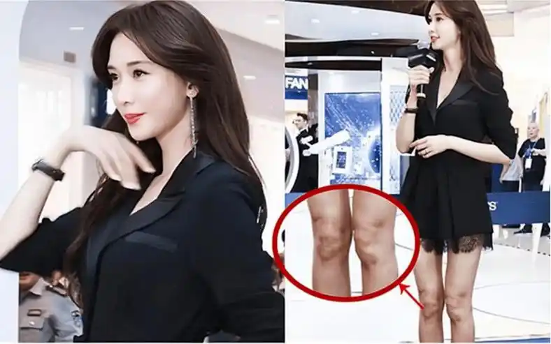 林志玲被日本丈夫家暴:鼻子被打坏,竟然还不离婚_台湾_消息_成为了