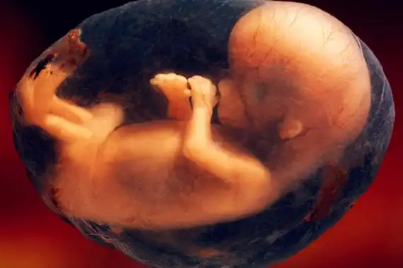 18周孕妇标准的肚子图快来看看吧附胎儿发育状况图及位置图