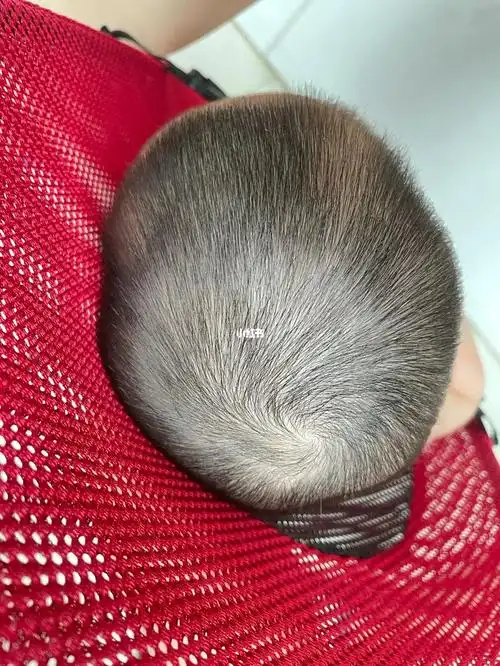 宝宝这个头型是不是不够圆?