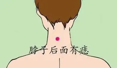 女人后背痣的位置与命运图解吉凶皆有