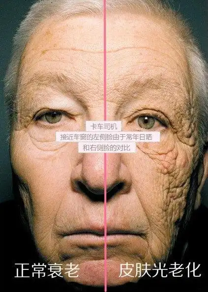 "阳光"对衰老造成的巨大影响令你难以想象 - 好大夫在线