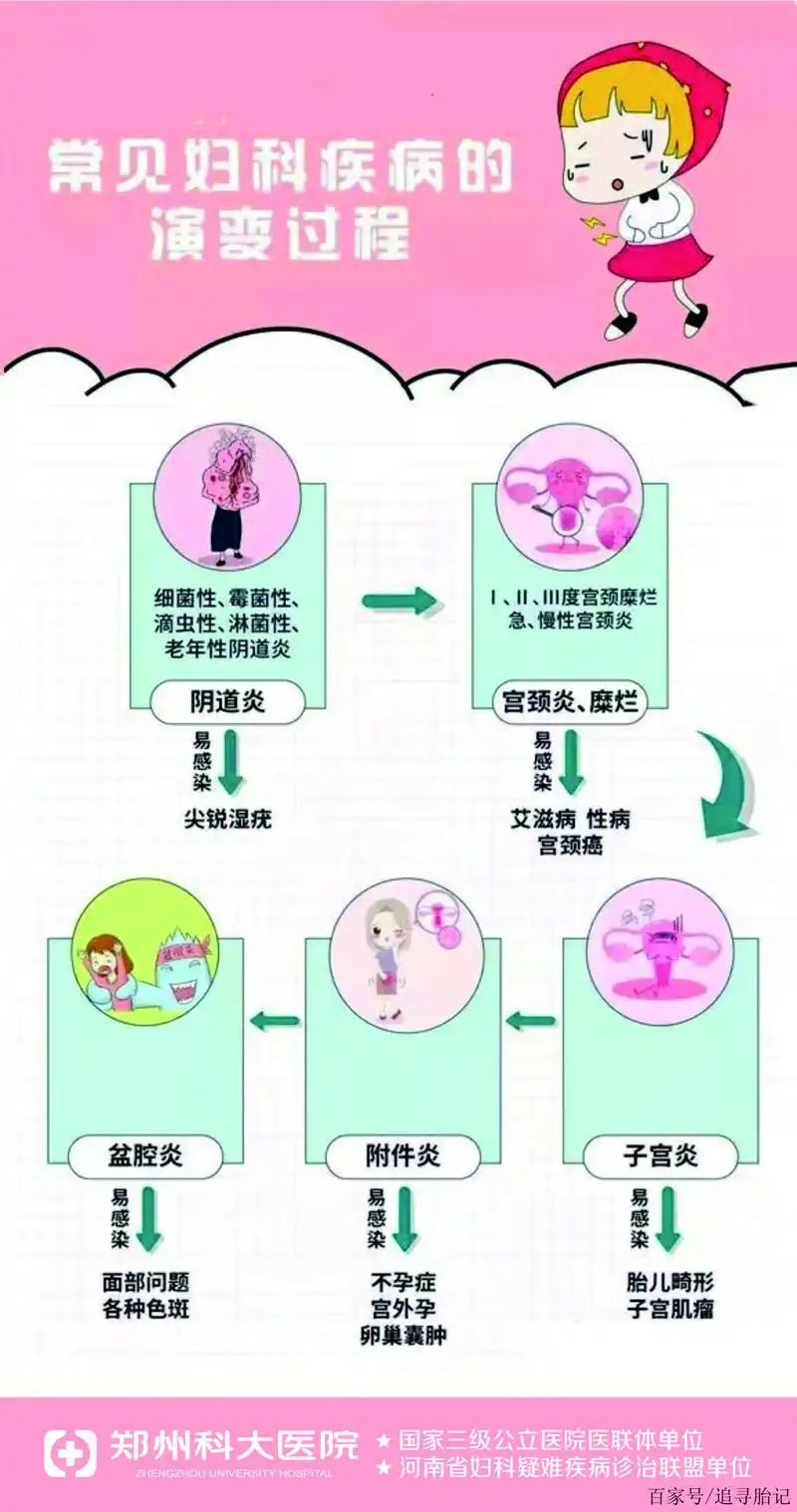郑州科大医院科普常见妇科疾病的演变过程