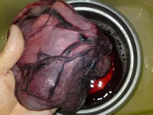 胎盘的制作工艺和食用方法