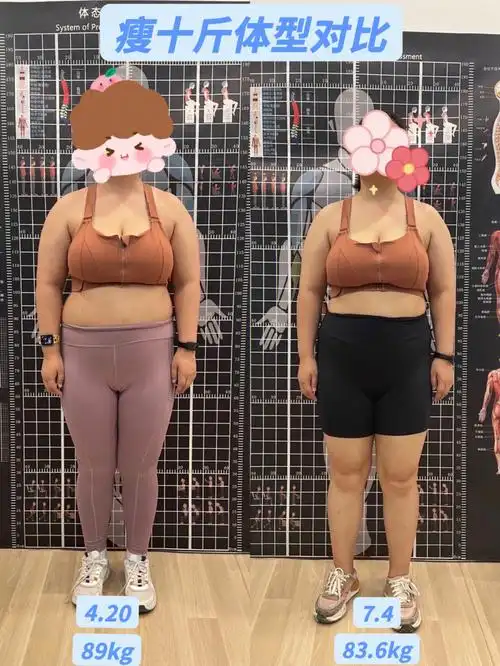 胰岛素抵抗减肥day666166瘦十斤体型对比