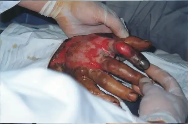 美宝集团_科技中心专家到广东,四川,重庆,河北多家医院会诊及临床学术