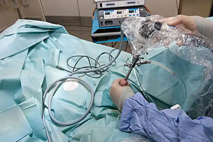 插入,结束,男人,阴茎,检查