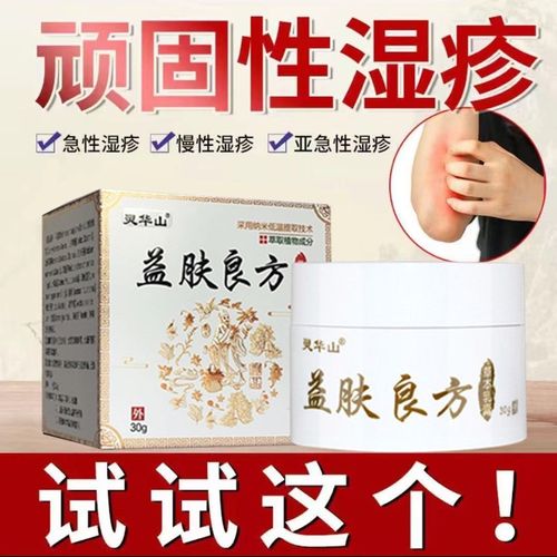 湿毒清专用皮炎湿疹过敏荨麻疹去湿毒湿痒汗疱疹股癣皮肤瘙痒止痒