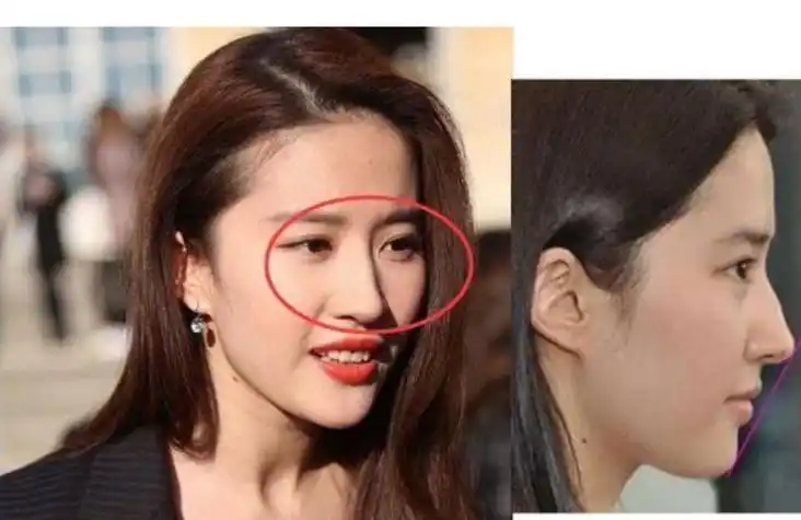 鼻梁凸起的女人面相 鼻梁有点凸起的女人