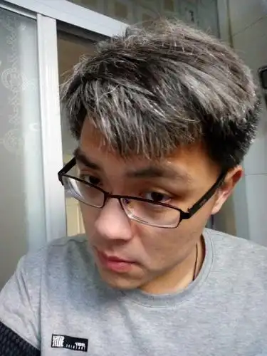 有少白头是怎样一种经历