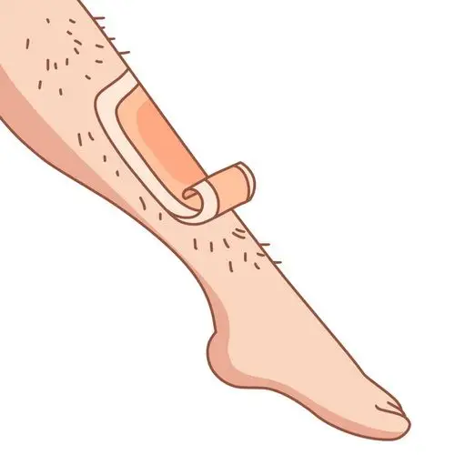 用胶带去腿毛卡通插画458376png图片素材