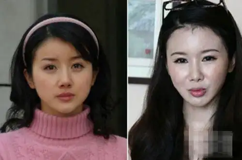 孙菲菲整容失败照片曝光 其整容前后照片显惊人对比