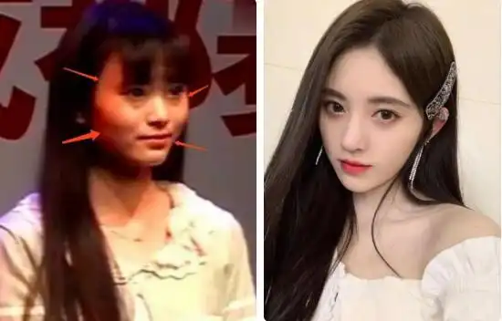 鞠婧祎整容网红前照片对比傻眼了出道前后的图片真的是同一个人吗