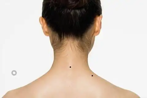 女人背后有痣好不好 女人后背有痣命运如何