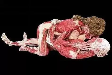 医学院储尸池 人体标本