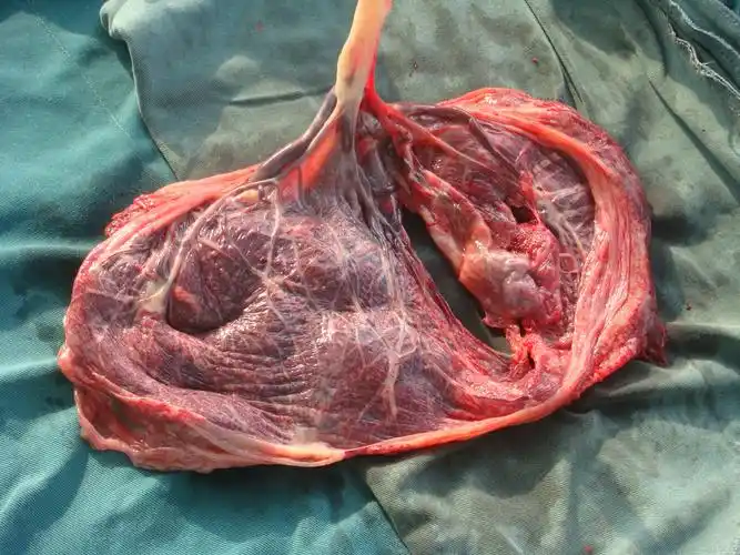 这个胎盘如何诊断