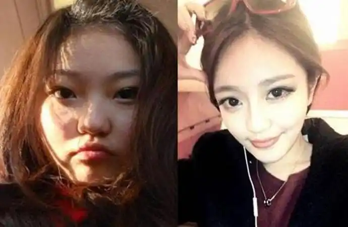 周扬青前后对比图曝光周扬青整容减肥前后长什么样