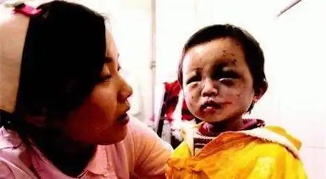 3岁被针线缝嘴,5岁被虐死,母亲出狱后将其挫骨扬灰_燕志云_女儿_虐待