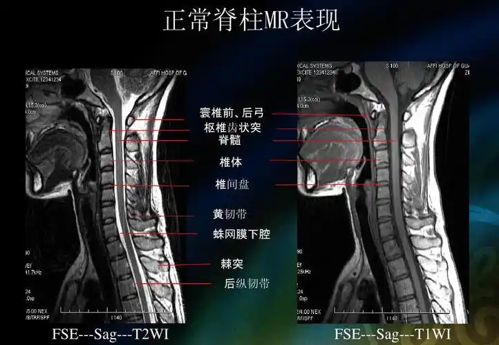 见习脊柱,五官mrippt