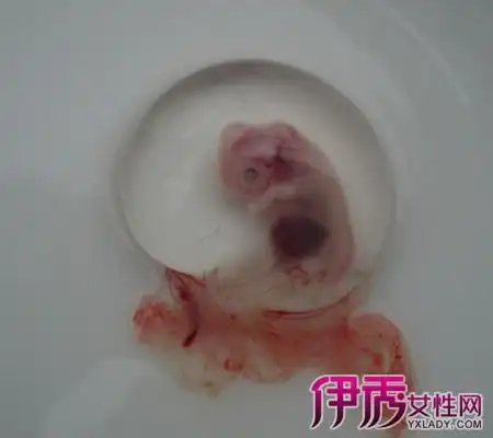 米非米索网上药店官网—2022最新正品药流药-健康资讯-皮村电商