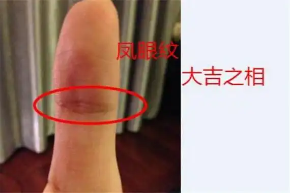 未闭合的凤眼纹命好吗左手凤眼纹未闭合可以聚财