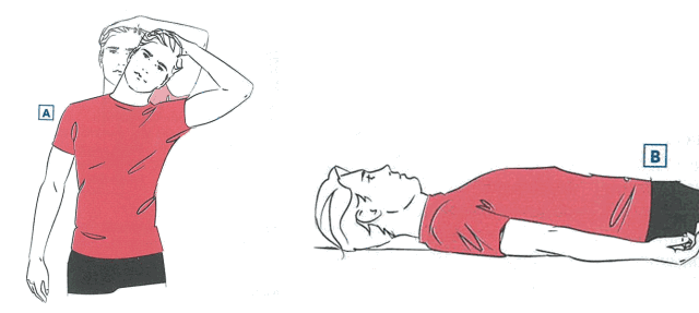 斜角肌弱最明显的症状就是跑步时头部和脖子看起来歪斜或前倾,有的跑