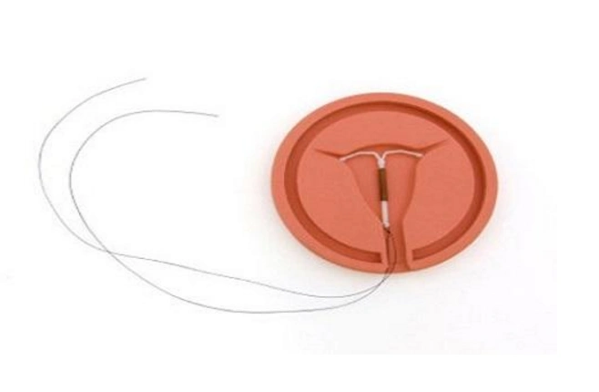 节育环长期不取出,会长进肉里吗?提醒:取环,尽量别超这个年龄