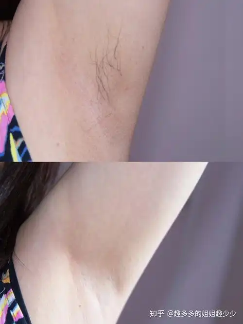 有多少女性会拔腋毛