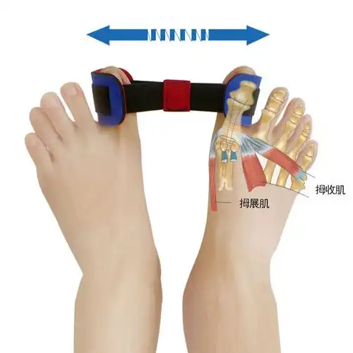 拇指外翻锻炼带康复器拇展肌训练带纠正拇外翻大脚骨脚趾外翻矫正器分