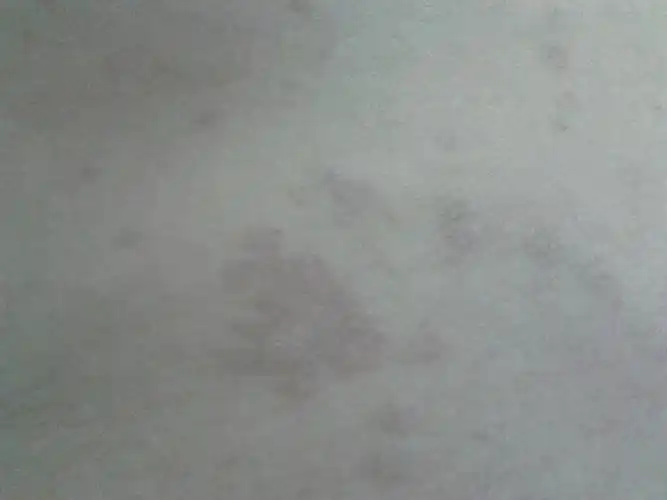 身上长了很多红斑,集中在肚子上胸上,不痒