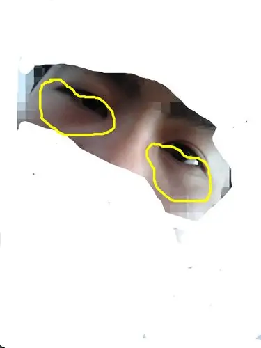 今年我17岁近视眼800度戴眼镜 把眼镜摘掉后拿镜子照眼睛黑黑的可难看