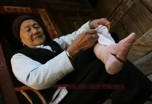 缠足图片