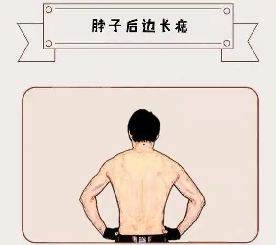 发财痣身体此处长吉痣贵人找上门金银满仓不发财都难