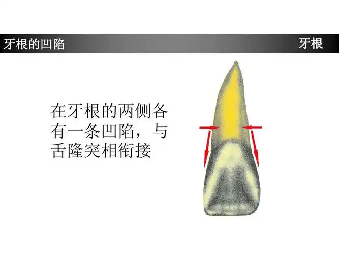 上颌中切牙形态特征简述