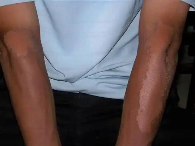 太阳除了把你脸晒黑还能晒出这些东东来