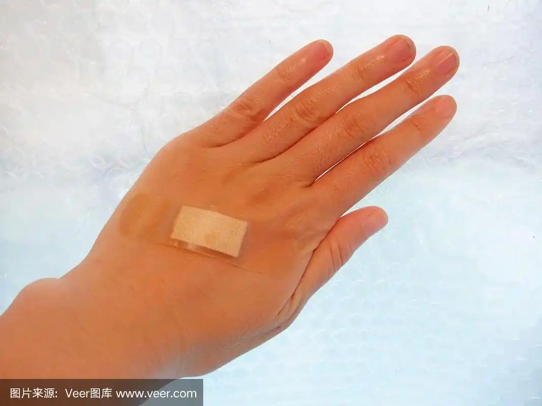 身体受伤,手,手背,创可贴,健康保健