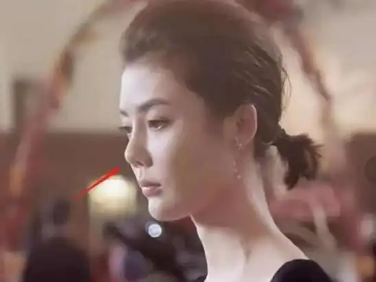 缩鼻翼要多少钱(连明星都折腾不好的鼻子) - 深圳信息港