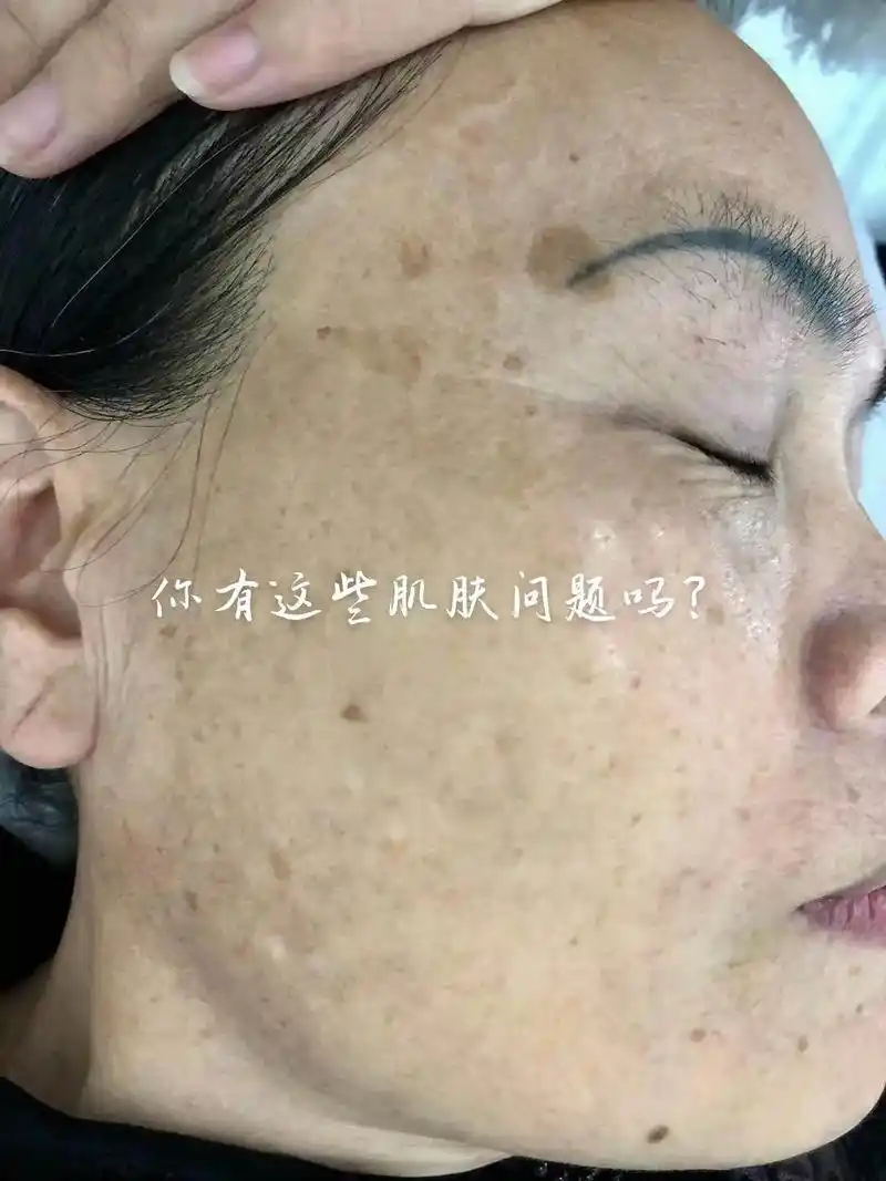 问题性皮肤管理 ##如何让皮肤变得细腻 - 抖音