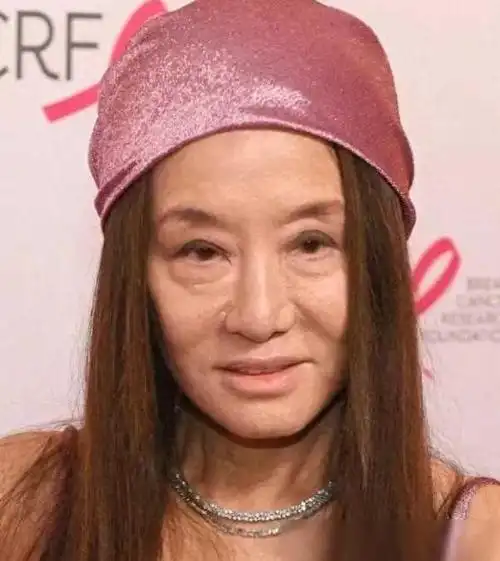 浑身皱纹,脸僵长斑,生图才是人间真实|娱乐圈|女明星_网易订阅