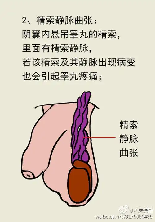 男人"蛋疼"是一种什么样的痛?