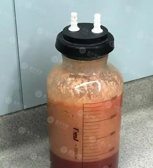 那些妹纸抽出来的脂肪,医院是怎么处理的?