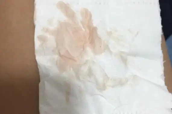 着床出血期间,你可能会感觉到晕眩,尽管你身体体质一直比较好,怀孕