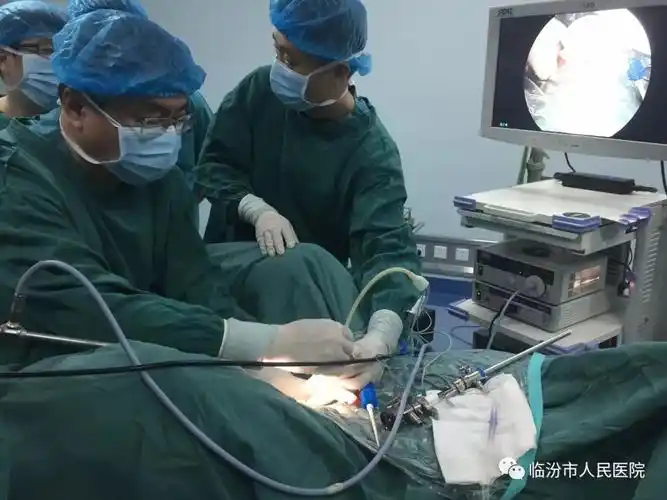 我院泌尿外一科完成一例经尿道柱状水囊前列腺扩开术技术新突破